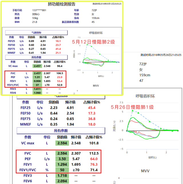 慢阻肺-呼吸訓(xùn)練器-肺功能檢測(cè)儀-肺炎-哮喘-海滄-賽客-咳喘