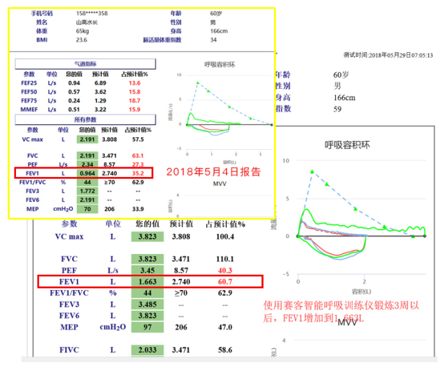 慢阻肺-呼吸訓(xùn)練器-肺功能檢測(cè)儀-肺炎-哮喘-海滄-賽客-咳喘