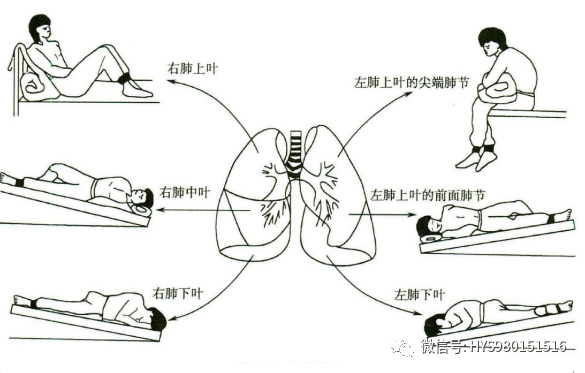 慢阻肺-痰多-咳痰-排痰-氣道廓清-康復(fù)-肺病-呼吸-肺功能檢測(cè)儀